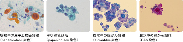 細胞診検査